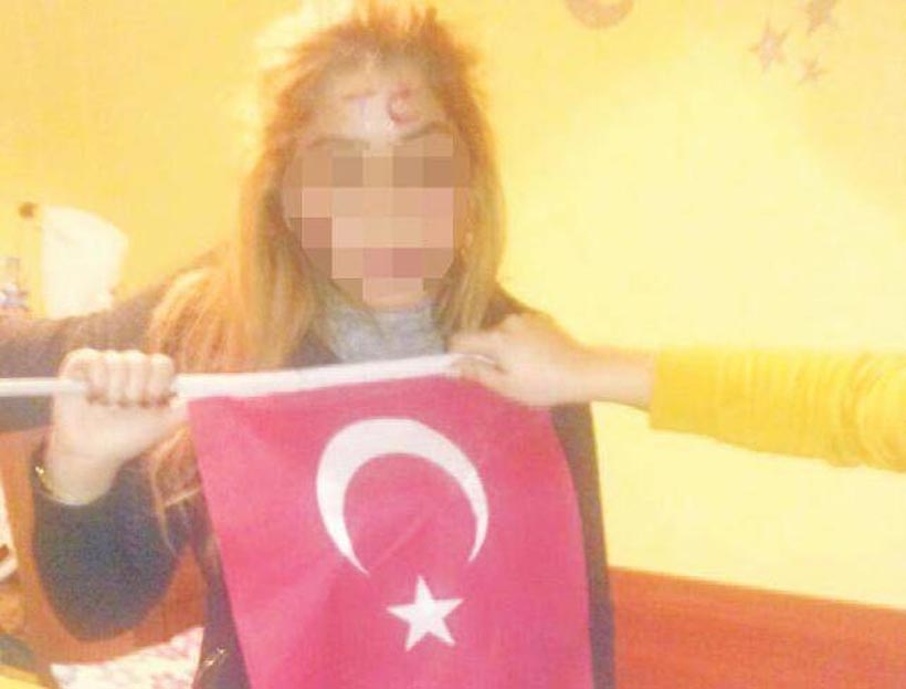 Kürt öğrencinin alnına rujla T.C. yazıp fotoğrafını paylaştılar